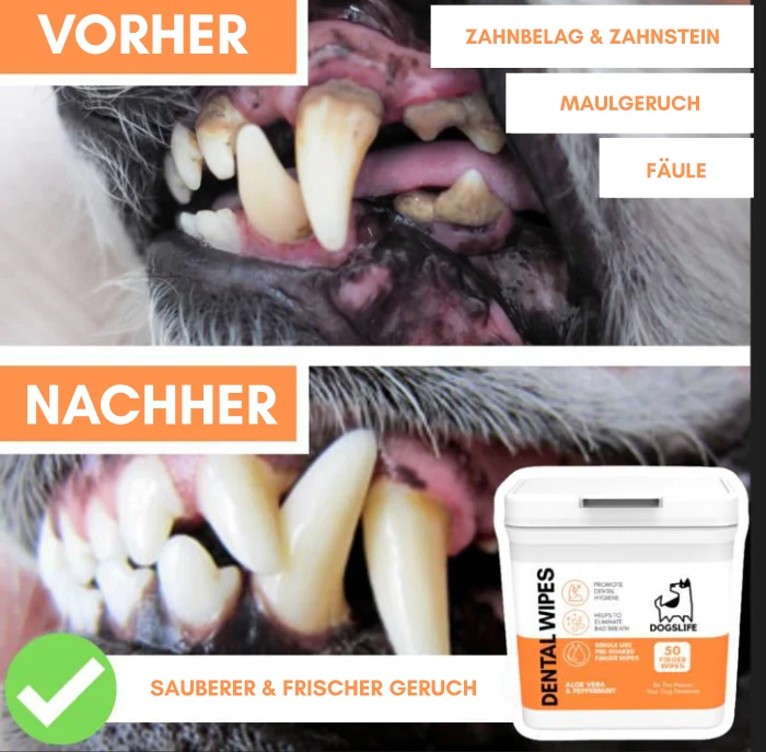 Dental Wipes Zahnputz-Fingerpads