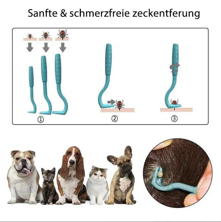 Zeckenentferner 3er Set mit V-Haken und Drehfunktion